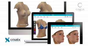 3 D krūtinės nosies modeliavimas Klaipėdoje
