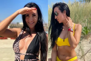viršutinių vokų operacija krūtinės korekcija abdominoplastika