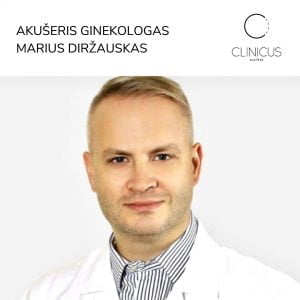 ginekologo operacijos