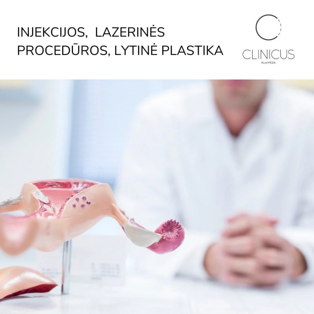 ginekologines operacijos