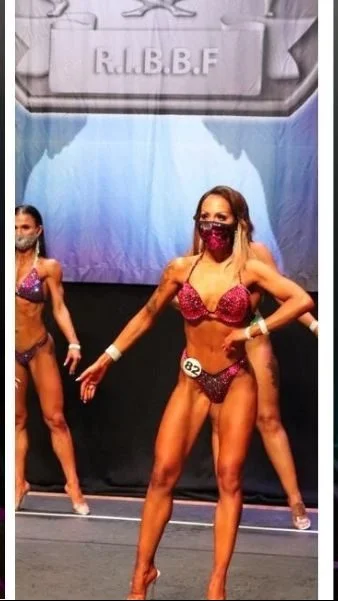 plastinė pilvo operacija