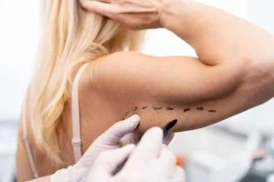 2. Breast augmentation using own fat in Lithuania