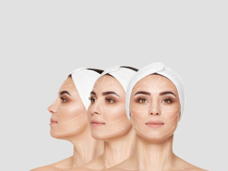 dermapen nano riebalai